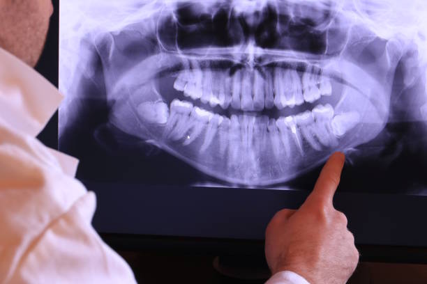 Best Emergency Tooth Extraction in Auburn, MI
